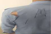 حمله یک قلاده سگ به واکسیناتور دامپزشکی